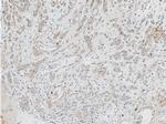 ACOT9 Antibody in Immunohistochemistry (Paraffin) (IHC (P))