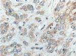 ACOT9 Antibody in Immunohistochemistry (Paraffin) (IHC (P))