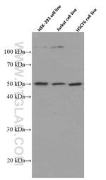 ACOT9 Antibody in Western Blot (WB)