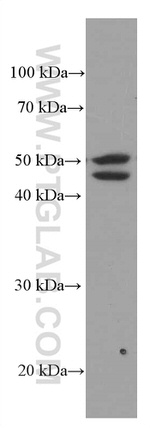 ACOT9 Antibody in Western Blot (WB)