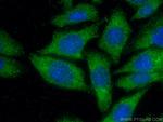 Cathepsin D Antibody in Immunocytochemistry (ICC/IF)