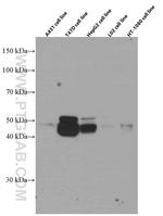 Cathepsin D Antibody in Western Blot (WB)