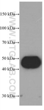 Cathepsin D Antibody in Western Blot (WB)