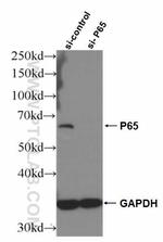 p65/RELA Antibody in Western Blot (WB)