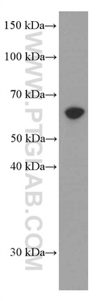 AMPK alpha Antibody in Western Blot (WB)