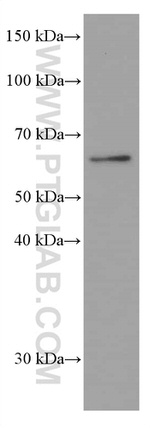 AMPK alpha Antibody in Western Blot (WB)