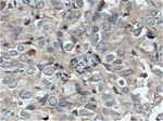 TWIST2 Antibody in Immunohistochemistry (Paraffin) (IHC (P))