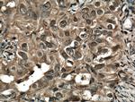 STAT1 Antibody in Immunohistochemistry (Paraffin) (IHC (P))