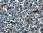 STAT1 Antibody in Immunohistochemistry (Paraffin) (IHC (P))