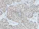 XRCC5 Antibody in Immunohistochemistry (Paraffin) (IHC (P))