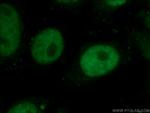 HuR Antibody in Immunocytochemistry (ICC/IF)