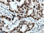 HuR Antibody in Immunohistochemistry (Paraffin) (IHC (P))