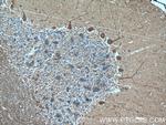 Huntingtin Antibody in Immunohistochemistry (Paraffin) (IHC (P))