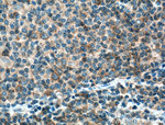 BCL10 Antibody in Immunohistochemistry (Paraffin) (IHC (P))