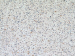 SMAD1 Antibody in Immunohistochemistry (Paraffin) (IHC (P))