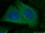 ATF6 Antibody in Immunocytochemistry (ICC/IF)