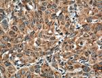 ATF6 Antibody in Immunohistochemistry (Paraffin) (IHC (P))