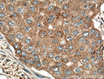 ATF6 Antibody in Immunohistochemistry (Paraffin) (IHC (P))