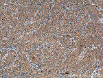 ATF6 Antibody in Immunohistochemistry (Paraffin) (IHC (P))