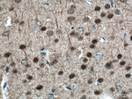 TBR1 Antibody in Immunohistochemistry (Paraffin) (IHC (P))