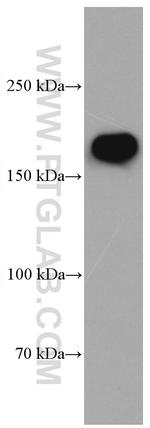 GRIN2B Antibody in Western Blot (WB)