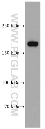 GRIN2B Antibody in Western Blot (WB)