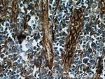 CD151 Antibody in Immunohistochemistry (Paraffin) (IHC (P))