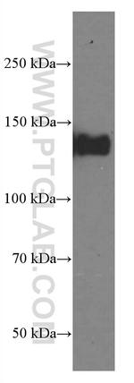 LATS1 Antibody in Western Blot (WB)