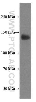 LATS1 Antibody in Western Blot (WB)