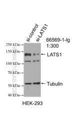 LATS1 Antibody in Western Blot (WB)