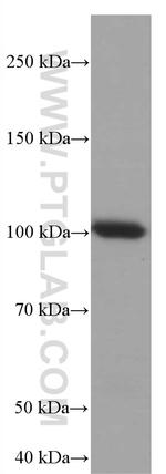 TLR5 Antibody in Western Blot (WB)