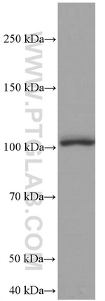 TLR5 Antibody in Western Blot (WB)