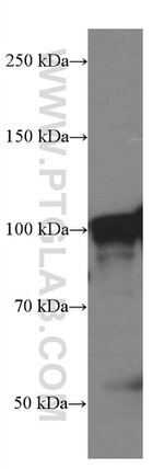 TLR5 Antibody in Western Blot (WB)