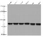 CIN85 Antibody in Western Blot (WB)