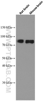 CIN85 Antibody in Western Blot (WB)