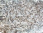 NUP62 Antibody in Immunohistochemistry (Paraffin) (IHC (P))