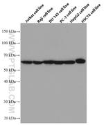 NUP62 Antibody in Western Blot (WB)