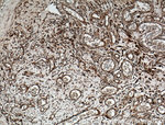 GRP78/BIP Antibody in Immunohistochemistry (Paraffin) (IHC (P))