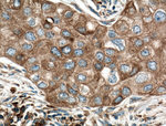 GRP78/BIP Antibody in Immunohistochemistry (Paraffin) (IHC (P))