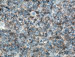 c-Cbl Antibody in Immunohistochemistry (Paraffin) (IHC (P))