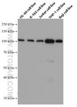 c-Cbl Antibody in Western Blot (WB)