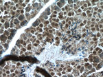 WBP2 Antibody in Immunohistochemistry (Paraffin) (IHC (P))