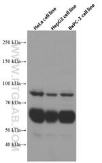 Beta galactosidase Antibody in Western Blot (WB)