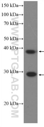 DNAJB6 Antibody in Western Blot (WB)