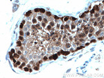 DNAJB6 Antibody in Immunohistochemistry (Paraffin) (IHC (P))