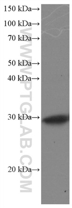 DNAJB6 Antibody in Western Blot (WB)