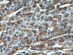 SDHA Antibody in Immunohistochemistry (Paraffin) (IHC (P))