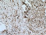 FASN Antibody in Immunohistochemistry (Paraffin) (IHC (P))