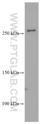 FASN Antibody in Western Blot (WB)