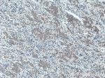 RAF1 Antibody in Immunohistochemistry (Paraffin) (IHC (P))